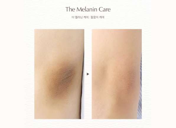 メラニンケア